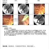 内镜图文影像处理系统