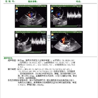 超声图文影像处理系统